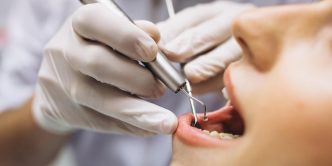 Periodontia em São Paulo - SP - Suzuki Dental Care